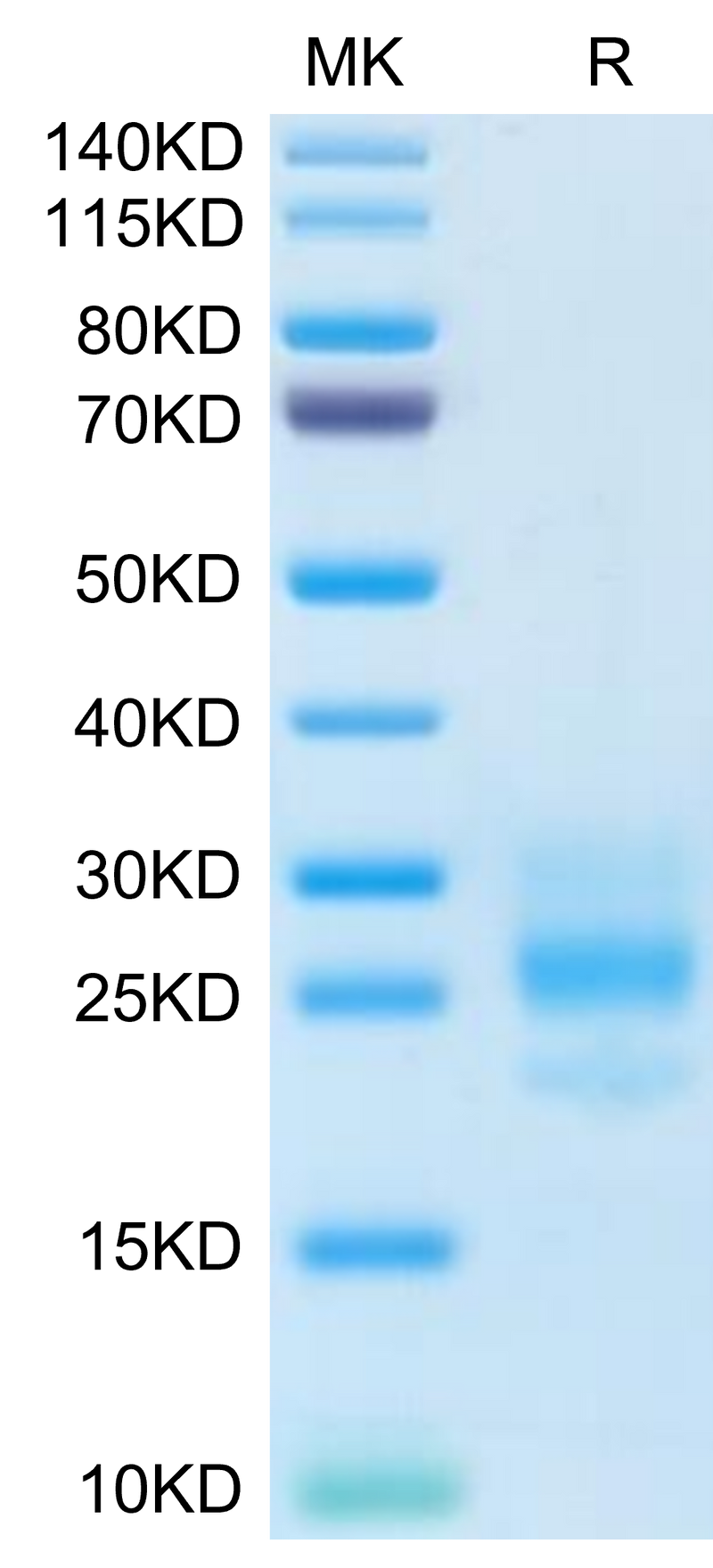 Human M-CSF on Tris-Bis PAGE under reduced condition. The purity is greater than 95%.Recombinant Human M-CSF/CSF-1 Protein, Active