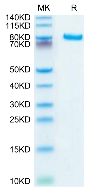 Human DLL4 on Tris-Bis PAGE under reduced conditions. The purity is greater than 95%.Recombinant Human DLL4 Protein, Active