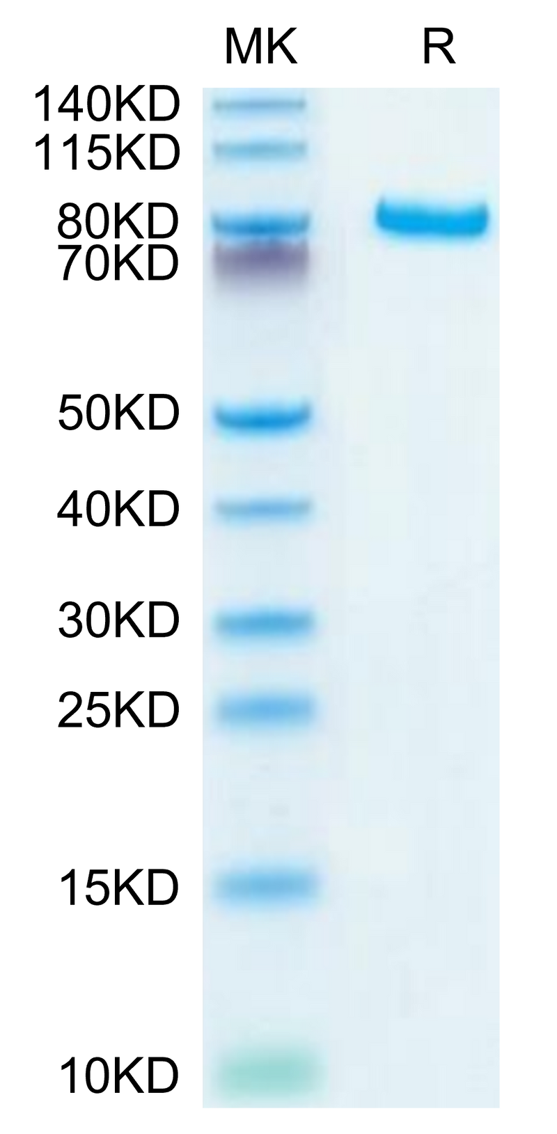 Human DLL4 on Tris-Bis PAGE under reduced conditions. The purity is greater than 95%.Recombinant Human DLL4 Protein, Active