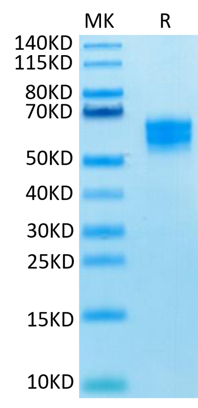Human NKG2D on Tris-Bis PAGE under reduced condition. The purity is greater than 95%.Recombinant Human NKG2D/CD314 Protein, Active