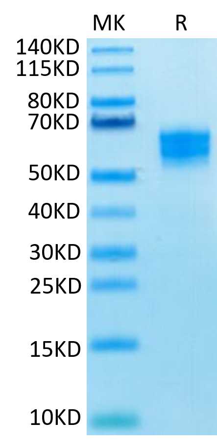 Human NKG2D on Tris-Bis PAGE under reduced condition. The purity is greater than 95%.Recombinant Human NKG2D/CD314 Protein, Active
