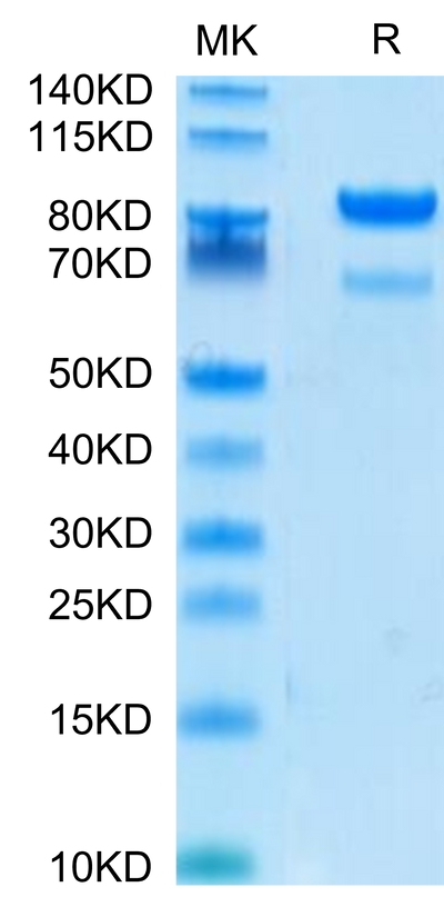 Human ROR2 on Tris-Bis PAGE under reduced conditions. The purity is greater than 95%.Recombinant Human ROR2/NTRKR2 Protein, Active