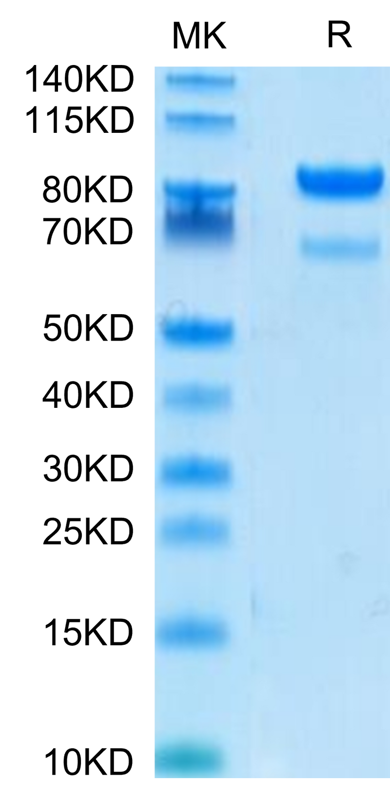 Human ROR2 on Tris-Bis PAGE under reduced conditions. The purity is greater than 95%.Recombinant Human ROR2/NTRKR2 Protein, Active