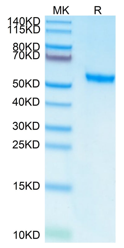 Human ROR2 on Tris-Bis PAGE under reduced conditions. The purity is greater than 95%.Recombinant Human ROR2/NTRKR2 Protein, Active