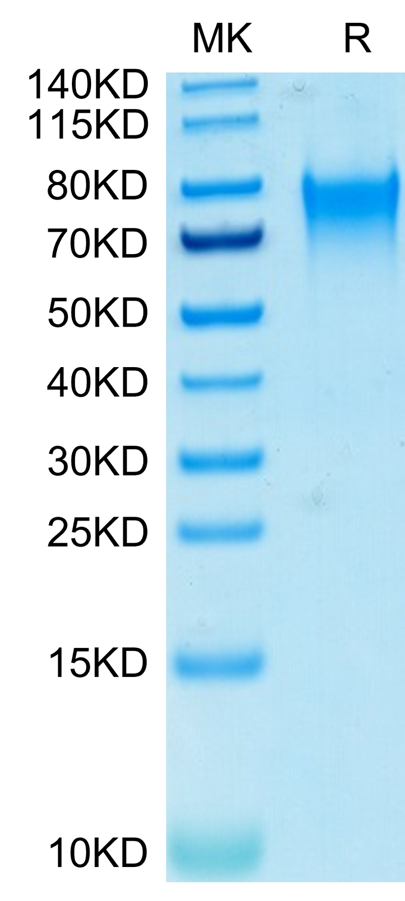 Biotinylated Human Nectin-3 on Tris-Bis PAGE under reduced conditions. The purity is greater than 95%.Biotinylated Human Nectin-3/CD113 Protein, Active