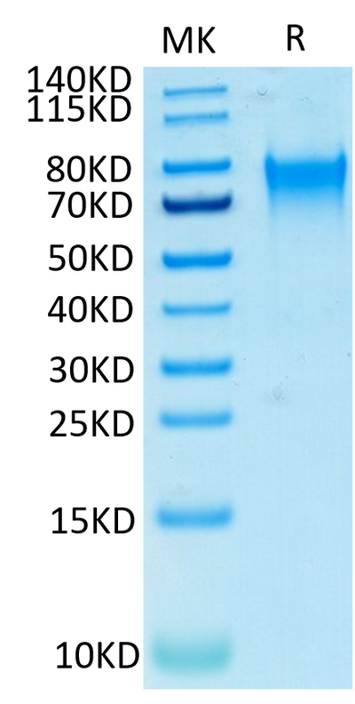 Human Nectin-3 on Tris-Bis PAGE under reduced conditions. The purity is greater than 95%.Recombinant Human Nectin-3/CD113 Protein, Active