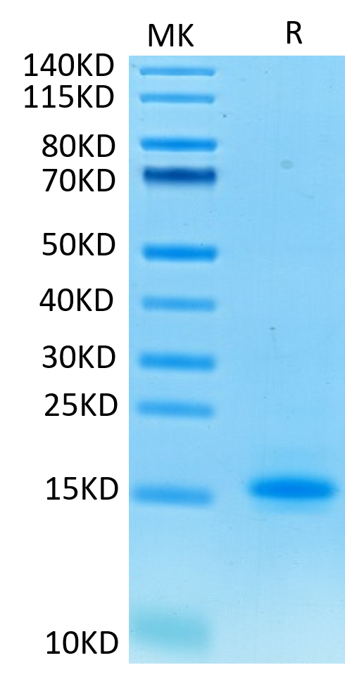 Human CD3E on Tris-Bis PAGE under reduced condition. The purity is greater than 95%.Recombinant Human CD3E/CD3 epsilon Protein, Active