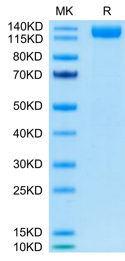 SARS-COV-2 Spike S1 on Tris-Bis PAGE under reduced condition. The purity is greater than 95%.Recombinant SARS-COV-2 Spike S1 Protein