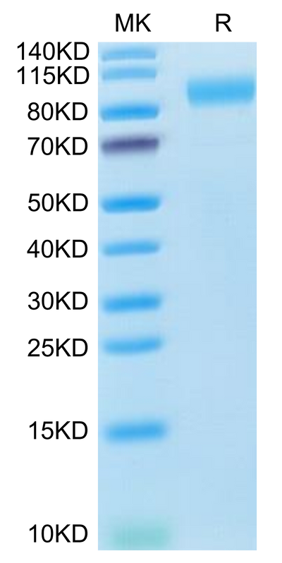 Human ACE2 on Tris-Bis PAGE under reduced condition. The purity is greater than 95%.Recombinant Human ACE2/ACEH Protein, Active
