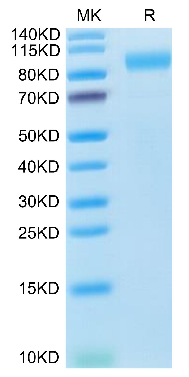 Human ACE2 on Tris-Bis PAGE under reduced condition. The purity is greater than 95%.Recombinant Human ACE2/ACEH Protein, Active