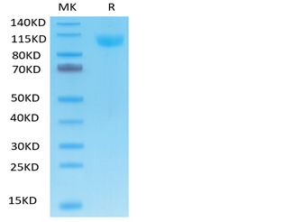 Human ACE2 on Tris-Bis PAGE under reduced condition. The purity is greater than 95%.Recombinant Human ACE2/ACEH Protein, Active