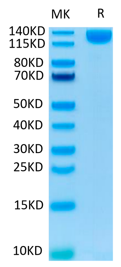 SARS-COV-2 Spike S1 on Tris-Bis PAGE under reduced condition. The purity is greater than 95%.Recombinant SARS-COV-2 Spike S1 Protein, Active