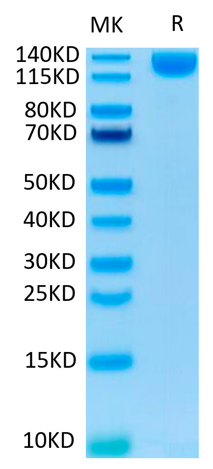 SARS-COV-2 Spike S1 on Tris-Bis PAGE under reduced condition. The purity is greater than 95%.Recombinant SARS-COV-2 Spike S1 Protein, Active