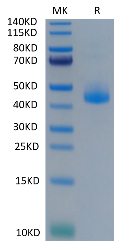 Cynomolgus CD3E on Tris-Bis PAGE under reduced condition. The purity is greater than 95%.Recombinant Cynomolgus CD3E/CD3 epsilon Protein, Active