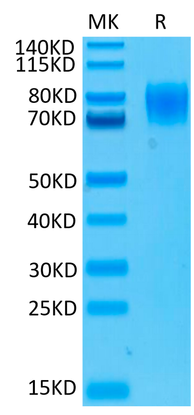 Human IFNAR1 on Tris-Bis PAGE under reduced conditions. The purity is greater than 95%.Recombinant Human IFN alpha/beta R1 Protein, Active