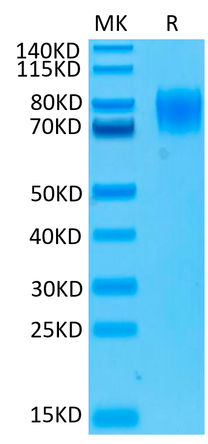Human IFNAR1 on Tris-Bis PAGE under reduced conditions. The purity is greater than 95%.Recombinant Human IFN alpha/beta R1 Protein, Active