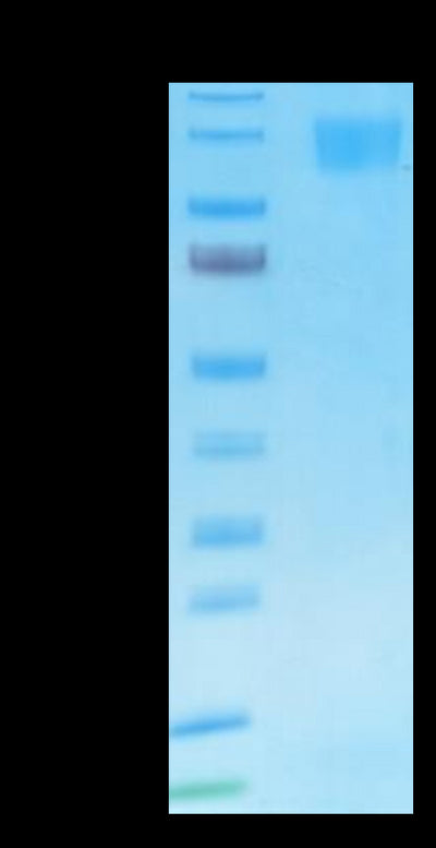 SARS Spike S1 on Tris-Bis PAGE under reduced condition. The purity is greater than 95%.Recombinant SARS Spike S1 Protein