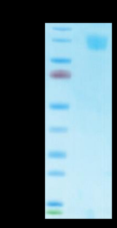 Biotinylated SARS Spike S1 on Tris-Bis PAGE under reduced condition. The purity is greater than 95%.Biotinylated SARS Spike S1 Protein