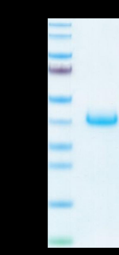 Biotinylated Human LILRB4 on Tris-Bis PAGE under reduced condition. The purity is greater than 95%.Biotinylated Human LILRB4/CD85k/ILT3 Protein, Active