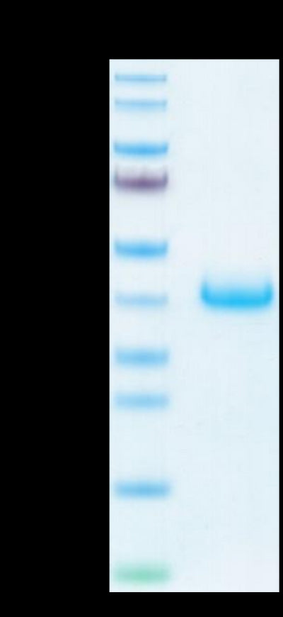 Human LILRB4 on Tris-Bis PAGE under reduced conditions. The purity is greater than 95%.Recombinant Human LILRB4/CD85k/ILT3 Protein, Active