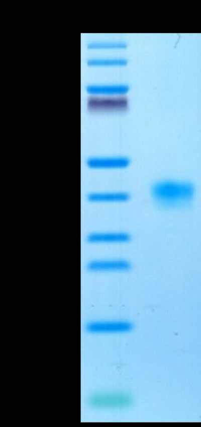 Cynomolgus LILRB4 on Tris-Bis PAGE under reduced condition. The purity is greater than 95%.Recombinant Cynomolgus LILRB4/CD85k/ILT3 Protein, Active