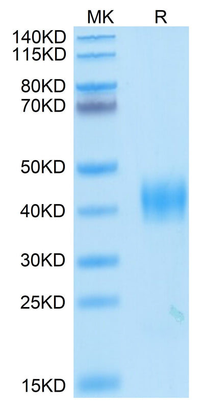 SARS Spike RBD on Tris-Bis PAGE under reduced condition. The purity is greater than 95%.Recombinant SARS Spike RBD Protein, Active