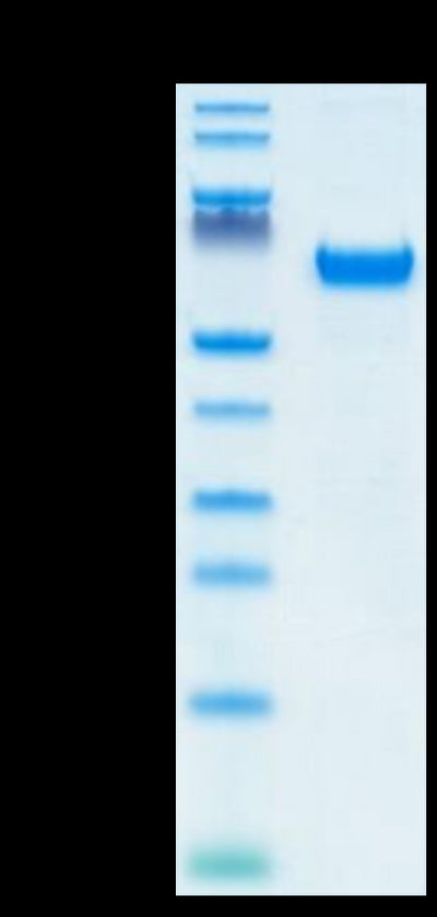 Human FOLR1 on Tris-Bis PAGE under reduced condition. The purity is greater than 95%.Recombinant Human FOLR1 Protein, Active