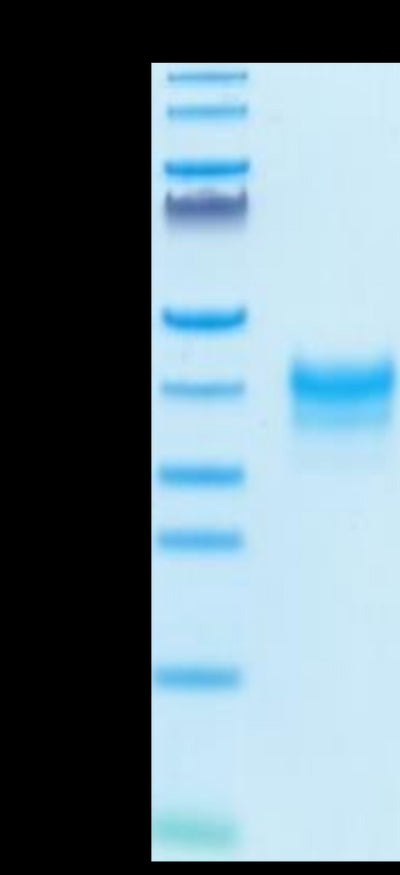 Cynomolgus/Rhesus macaque FOLR1 on Tris-Bis PAGE under reduced condition. The purity is greater than 95%.Recombinant Cynomolgus/Rhesus macaque FOLR1 Protein, Active