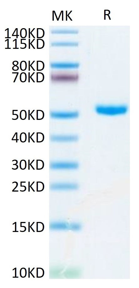 Human CD4 on Tris-Bis PAGE under reduced condition. The purity is greater than 95%.Recombinant Human CD4/LEU3 Protein, Active