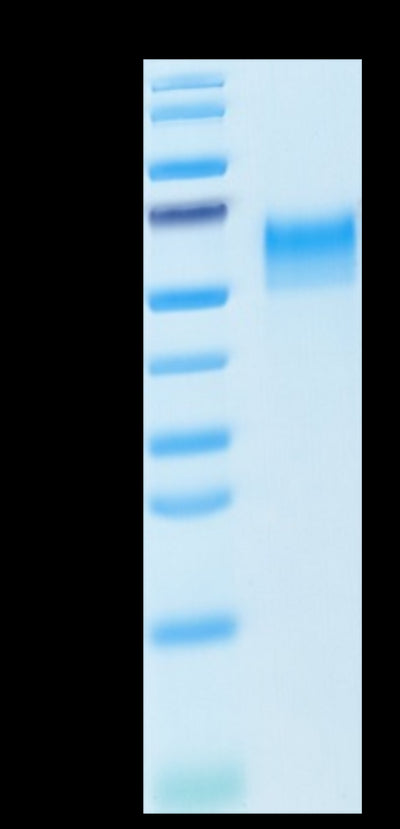 Mouse CD4 on Tris-Bis PAGE under reduced condition. The purity is greater than 95%.Recombinant Mouse CD4/LEU3 Protein