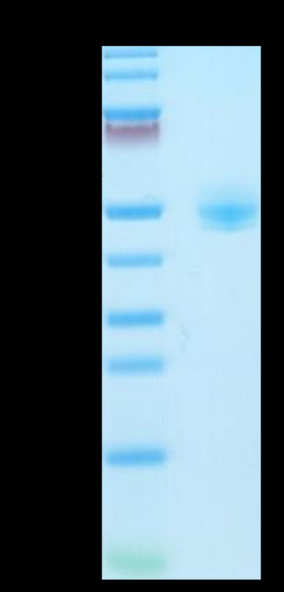 Rhesus macaque CD4 on Tris-Bis PAGE under reduced condition. The purity is greater than 95%.Recombinant Rhesus macaque CD4/LEU3 Protein, Active