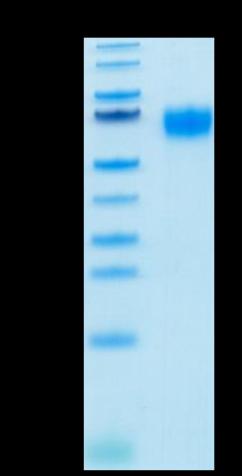Biotinylated Human IL-2 R gamma on Tris-Bis PAGE under reduced condition. The purity is greater than 95%.Biotinylated Human IL-2 R gamma/CD132 Protein