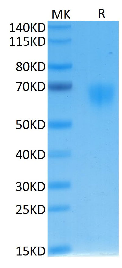 Human IL-2 R gamma on Tris-Bis PAGE under reduced condition. The purity is greater than 95%.Recombinant Human IL-2 R gamma/CD132 Protein