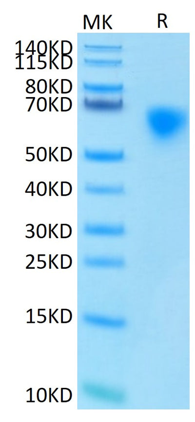 Human MICA on Tris-Bis PAGE under reduced condition. The purity is greater than 95%.Recombinant Human MICA Protein, Active