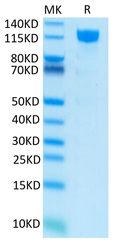 Human M-CSF R on Tris-Bis PAGE under reduced condition. The purity is greater than 95%.Recombinant Human M-CSF R/CSF1R/CD115 Protein, Active