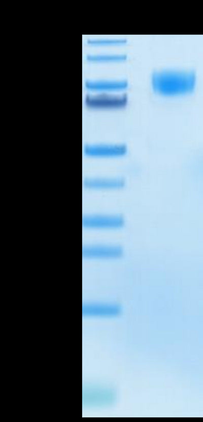 Human M-CSF R Tris-Bis PAGE under reduced condition. The purity is greater than 95%.Recombinant Human M-CSF R/CSF1R/CD115 Protein, Active