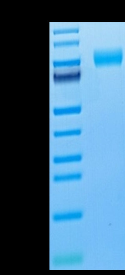 Cynomolgus M-CSF R on Tris-Bis PAGE under reduced condition. The purity is greater than 95%.Recombinant Cynomolgus M-CSF R/CSF1R/CD115 Protein, Active