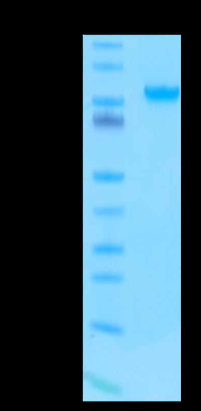 Human/Cynomolgus/Rhesus macaque ROR1 on Tris-Bis PAGE under reduced condition. The purity is greater than 95%.Recombinant Human/Cynomolgus/Rhesus macaque ROR1 Protein, Active
