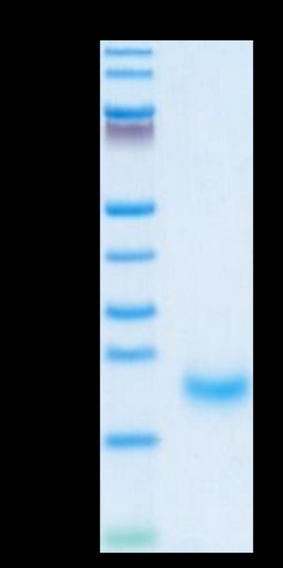 Human/Cynomolgus/Rhesus macaque ROR1 (308-395, Kringle Domain) on Tris-Bis PAGE under reduced condition. The purity is greater than 95%.Recombinant Human/Cynomolgus/Rhesus macaque ROR1 (308-395, Kringle Domain) Protein