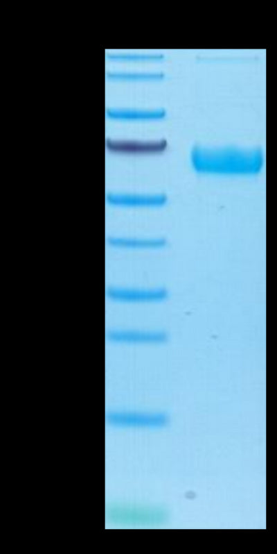 Human/Cynomolgus/Rhesus macaque ROR1 on Tris-Bis PAGE under reduced condition. The purity is greater than 95%.Recombinant Human/Cynomolgus/Rhesus macaque ROR1 Protein, Active