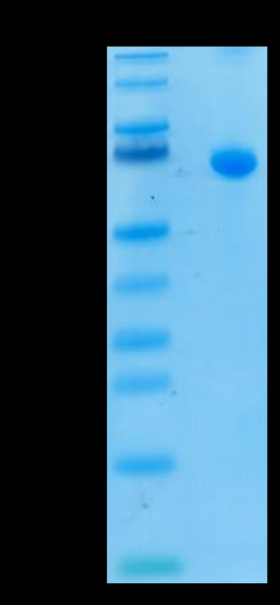 Human IL-13Ra2 on Tris-Bis PAGE under reduced condition. The purity is greater than 95%.Recombinant Human IL-13Ra2 Protein, Active