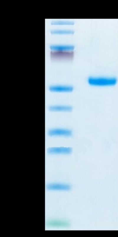 Mouse IL-5 R alpha on Tris-Bis PAGE under reduced condition. The purity is greater than 95%.Recombinant Mouse IL-5 R alpha/CD125 Protein, Active