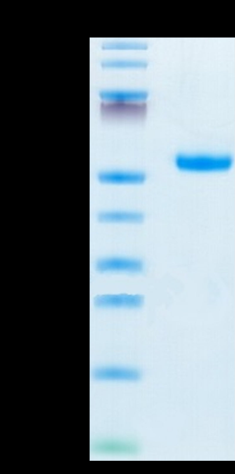 Mouse IL-5 R alpha on Tris-Bis PAGE under reduced condition. The purity is greater than 95%.Recombinant Mouse IL-5 R alpha/CD125 Protein, Active