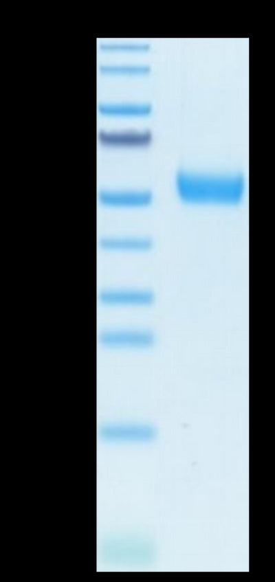 Human IL-5R alpha on Tris-Bis PAGE under reduced condition. The purity is greater than 95%.Recombinant Human IL-5 R alpha/CD125 Protein, Active