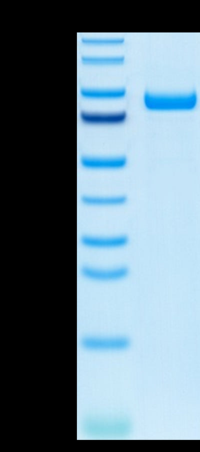 Human IL-5R alpha on Tris-Bis PAGE under reduced condition. The purity is greater than 95%.Recombinant Human IL-5 R alpha/CD125 Protein, Active