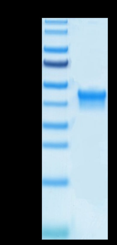 Biotinylated Human IL-2 R alpha on Tris-Bis PAGE under reduced condition. The purity is greater than 95%.