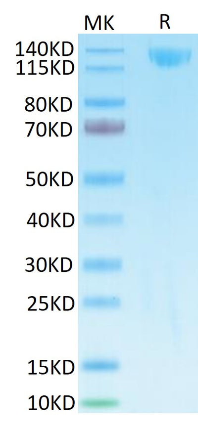 SARS Spike S1 on Tris-Bis PAGE under reduced condition. The purity is greater than 95%.Recombinant SARS Spike S1 Protein, Active