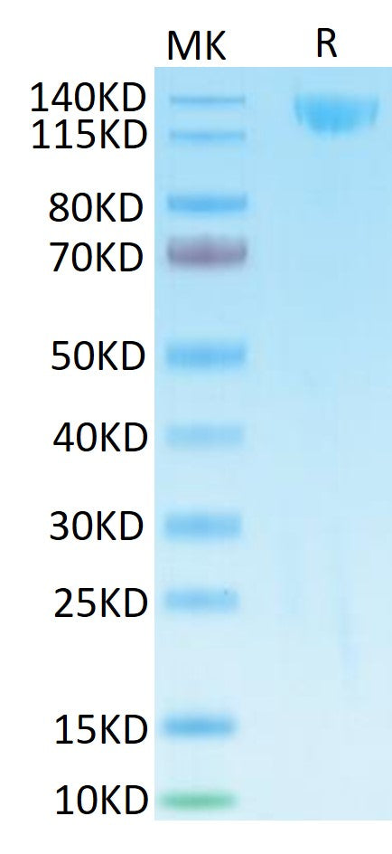 SARS Spike S1 on Tris-Bis PAGE under reduced condition. The purity is greater than 95%.Recombinant SARS Spike S1 Protein, Active