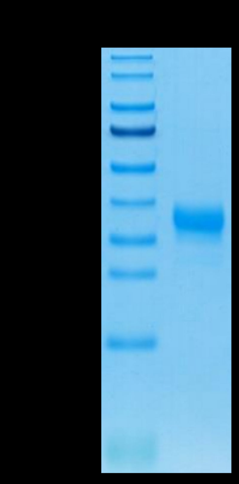 Human Fc gamma RIIA (H167) on Tris-Bis PAGE under reduced condition. The purity is greater than 95%.