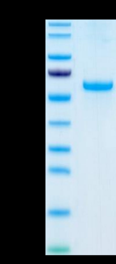 Human Adiponectin on Tris-Bis PAGE under reduced condition. The purity is greater than 95%.Recombinant Human Adiponectin/Acrp30 Protein